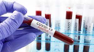 2 fresh positive cases on Saturday for Covid-19 out of 517 tests, Active cases 26 & 5 Discharges in district